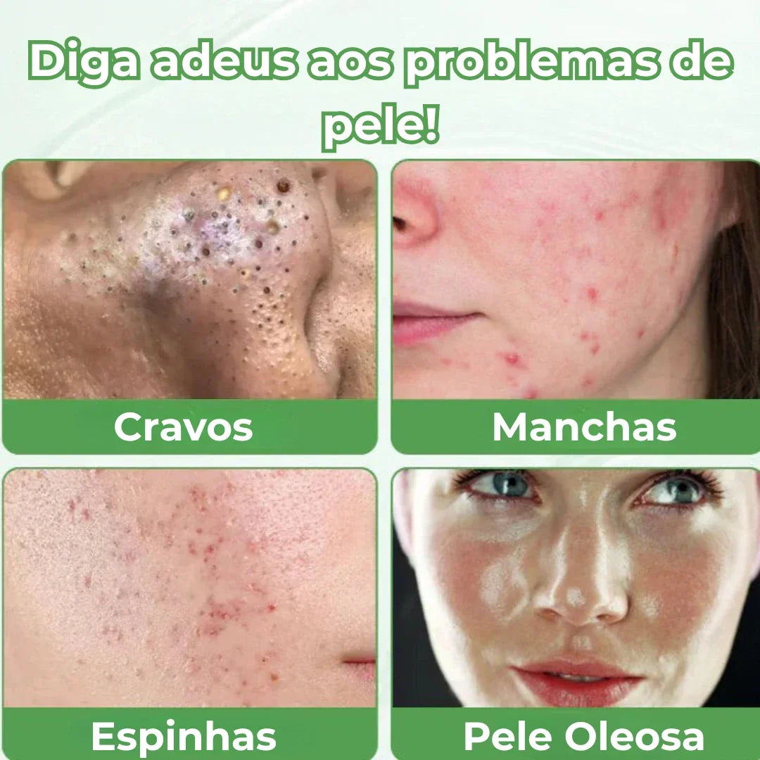 Suzune - Stick Facial Chá Verde - Suzune