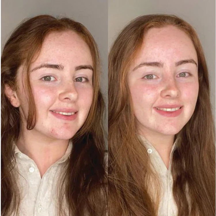 Antes e Depois